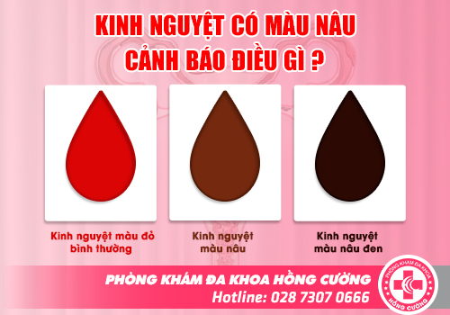 kinh nguyệt màu bất thường