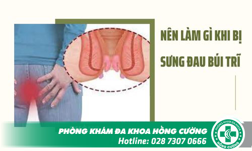 Nên làm gì khi bị sưng đau búi trĩ?